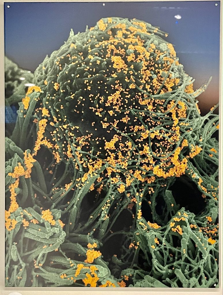 Cellules bronchiques humaines (en vert) infectées par SARS-CoV-2 (en orange), 2020. Crédit photo : Alexandra Foucher.